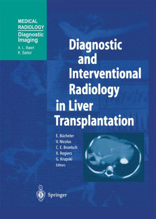 Cover of the book Diagnostic and Interventional Radiology in Liver Transplantation by , Springer Berlin Heidelberg