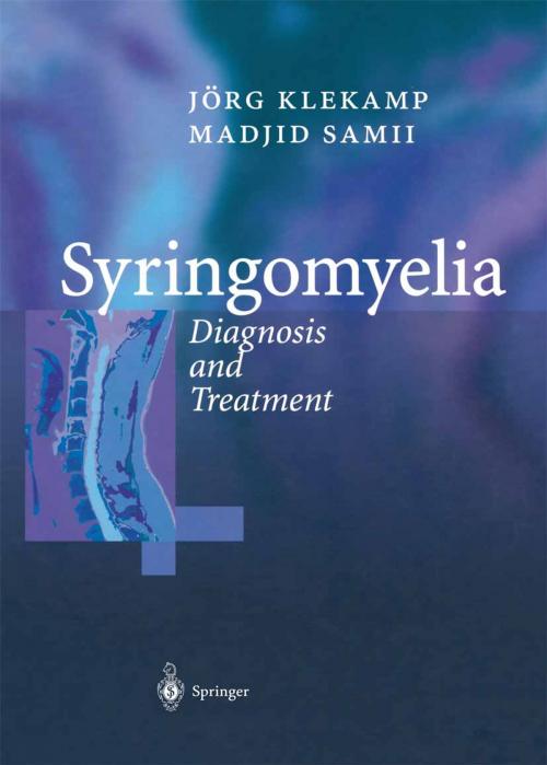 Cover of the book Syringomyelia by Madjid Samii, C. Matthies, Jörg Klekamp, Springer Berlin Heidelberg