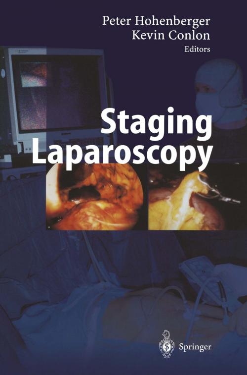 Cover of the book Staging Laparoscopy by , Springer Berlin Heidelberg
