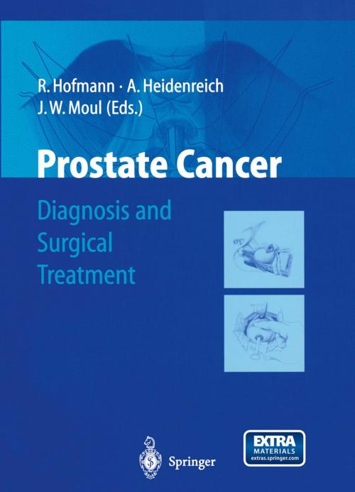 Cover of the book Prostate Cancer by , Springer Berlin Heidelberg