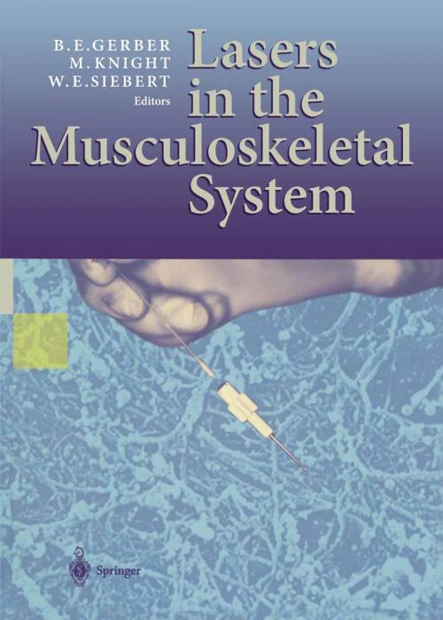 Cover of the book Lasers in the Musculoskeletal System by , Springer Berlin Heidelberg