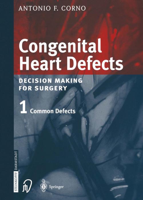 Cover of the book Congenital Heart Defects by Antonio F. Corno, Steinkopff