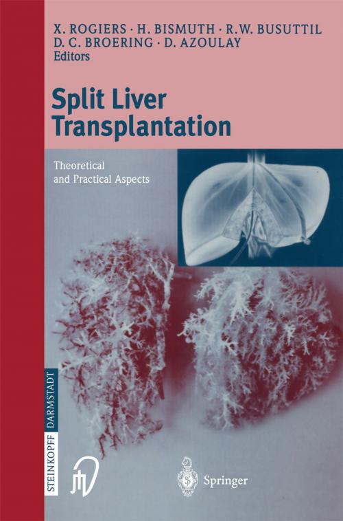 Cover of the book Split liver transplantation by , Steinkopff