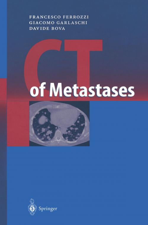 Cover of the book CT of Metastases by Francesco Ferrozzi, P. Bassi, Giacomo Garlaschi, Davide Bova, Springer Berlin Heidelberg