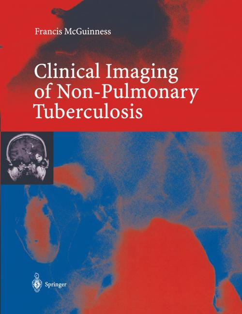 Cover of the book Clinical Imaging in Non-Pulmonary Tuberculosis by Francis E. McGuinness, D. Hamilton, J.A. Nabulsi, Springer Berlin Heidelberg