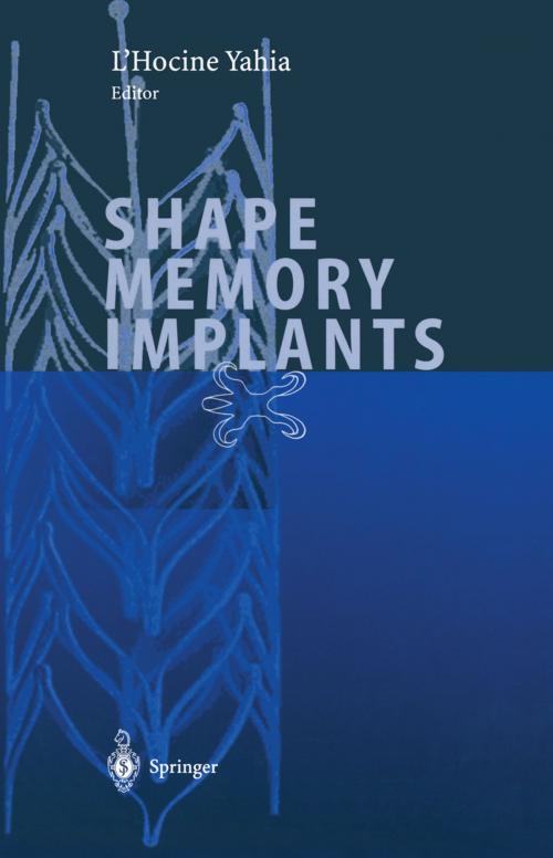 Cover of the book Shape Memory Implants by , Springer Berlin Heidelberg