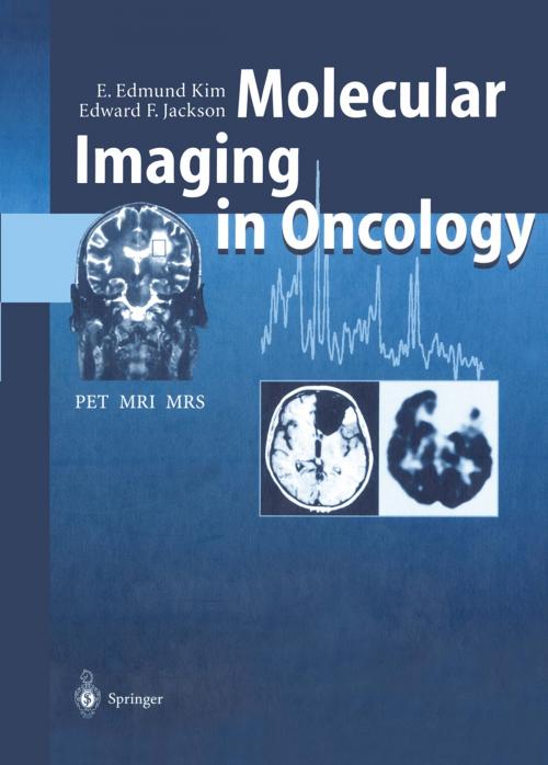 Cover of the book Molecular Imaging in Oncology by E. Edmund Kim, J. Aoki, H. Baghaei, Edward F. Jackson, S. Ilgan, T. Inoue, H. Li, J. Uribe, F.C.L. Wong, W.-H. Wong, D.J. Yang, Springer Berlin Heidelberg