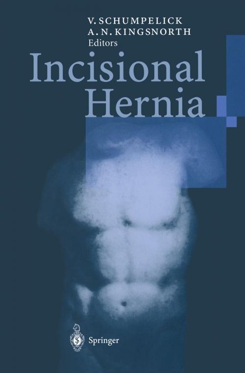 Cover of the book Incisional Hernia by , Springer Berlin Heidelberg