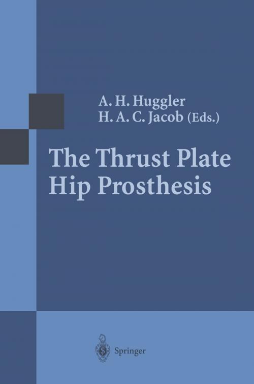 Cover of the book The Thrust Plate Hip Prosthesis by , Springer Berlin Heidelberg