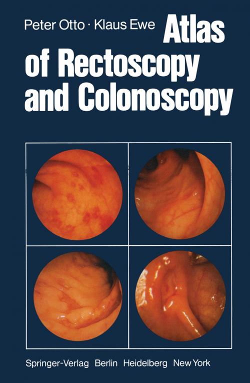 Cover of the book Atlas of Rectoscopy and Coloscopy by P. Otto, K. Ewe, Springer Berlin Heidelberg