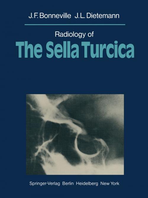 Cover of the book Radiology of The Sella Turcica by J. Metzger, J. C. Demandre, A. Wackenheim, J. F. Bonneville, G. Didierlaurent, J. L. Dietemann, C. Edus, P. Gresyk, M. Pion, N. Quantin, T. Taillard, Springer Berlin Heidelberg