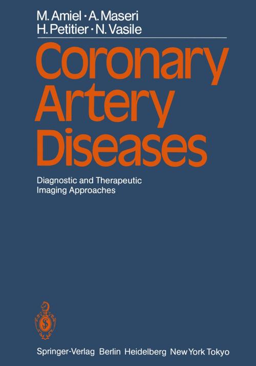 Cover of the book Coronary Artery Diseases by M. Amiel, W. Benicelli, A. Maseri, P. Brun, P. A. Crean, H. Petitier, N. Vasile, D. Crochet, G. J. Davis, P. Gaspard, P. Mikaeloff, A. L. Muir, G. Pelle, A. P. Selwyn, P. Vignon, Springer Berlin Heidelberg