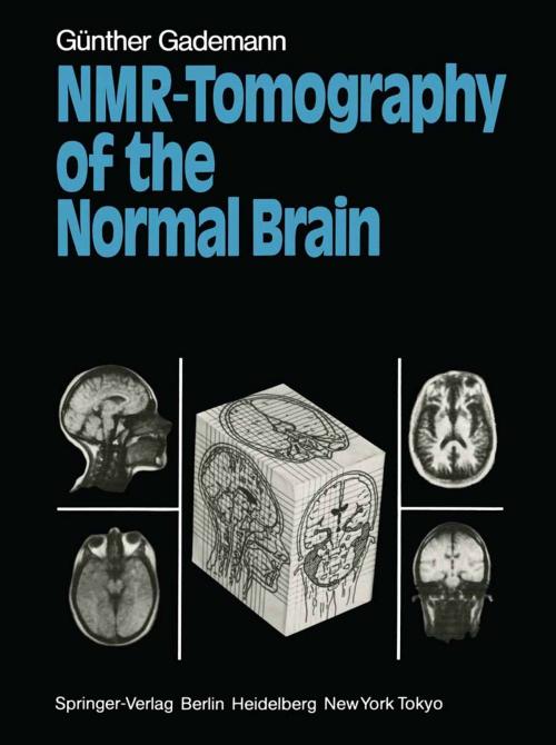 Cover of the book NMR-Tomography of the Normal Brain by Günther Gademann, Springer Berlin Heidelberg
