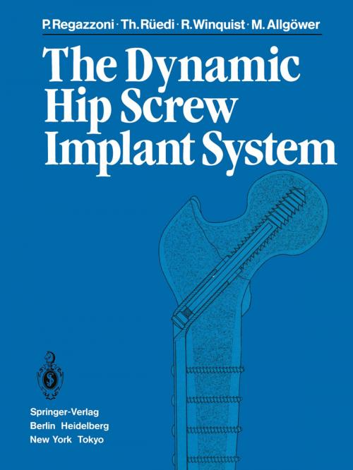 Cover of the book The Dynamic Hip Screw Implant System by P. Regazzoni, R. Winquist, M. Allgöwer, T. Rüedi, Springer Berlin Heidelberg