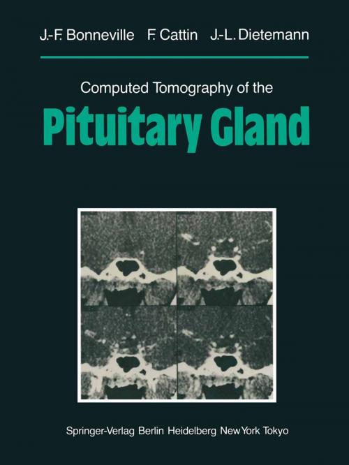 Cover of the book Computed Tomography of the Pituitary Gland by M. Mu Huo Teng, Jean-Francois Bonneville, F. Cattin, K. Sartor, Jean-Louis Dietemann, Springer Berlin Heidelberg