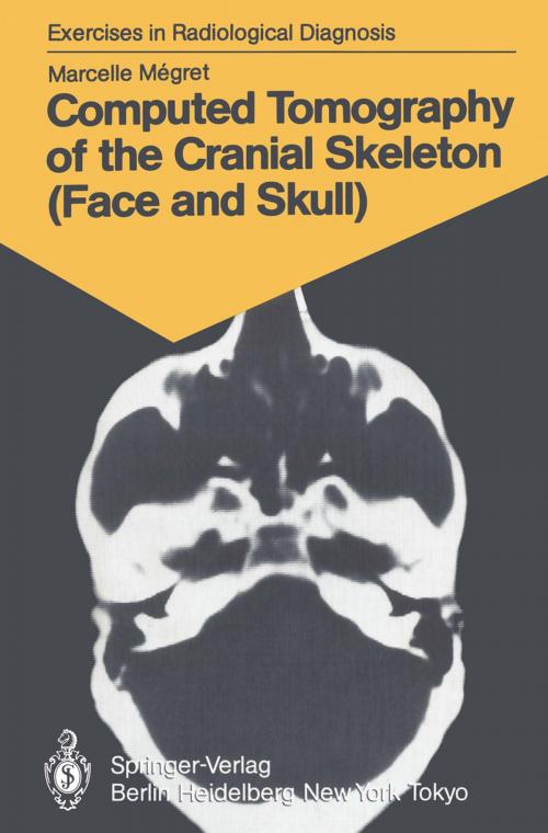 Cover of the book Computed Tomography of the Cranial Skeleton (Face and Skull) by Marcelle Megret, Springer Berlin Heidelberg
