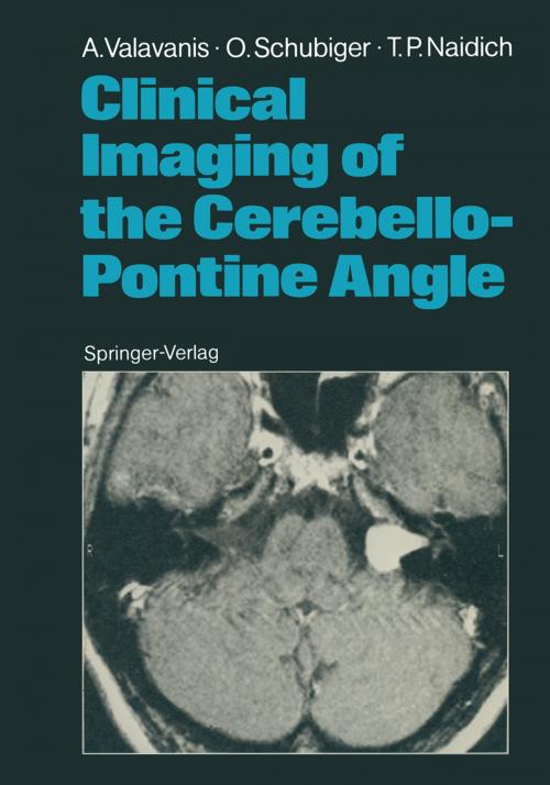 Cover of the book Clinical Imaging of the Cerebello-Pontine Angle by Anton Valavanis, Othmar Schubiger, Thomas P. Naidich, Springer Berlin Heidelberg