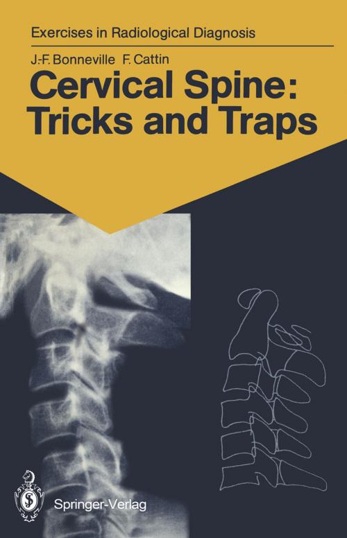 Cover of the book Cervical Spine: Tricks and Traps by Jean-Francois Bonneville, Francoise Cattin, Springer Berlin Heidelberg
