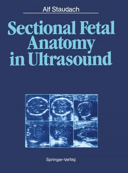 Cover of the book Sectional Fetal Anatomy in Ultrasound by Alf Staudach, W. Thiel, Bernd K. Wittmann, M. Hansmann, J. Hobbins, Springer Berlin Heidelberg