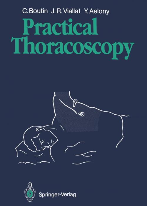 Cover of the book Practical Thoracoscopy by F. Rey, Christian Boutin, Jean R. Viallat, Yossef Aelony, Springer Berlin Heidelberg