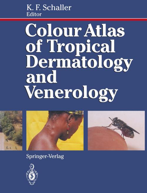 Cover of the book Colour Atlas of Tropical Dermatology and Venerology by F.A. Bahmer, W. Büttner, H. Lieske, H. Rieth, S.W. Wassilev, F. Weyer, Springer Berlin Heidelberg