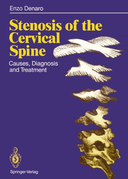 Cover of the book Stenosis of the Cervical Spine by Vincenzo Denaro, Springer Berlin Heidelberg
