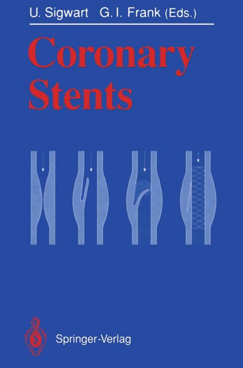 Cover of the book Coronary Stents by , Springer Berlin Heidelberg