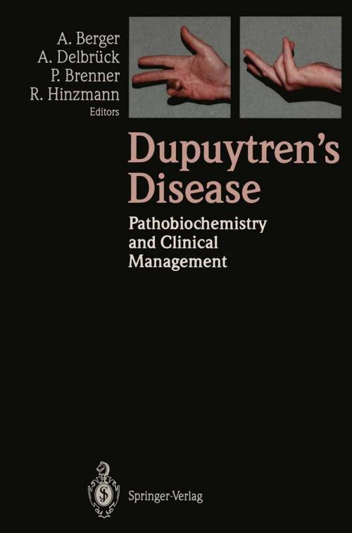 Cover of the book Dupuytren’s Disease by , Springer Berlin Heidelberg
