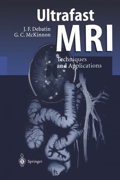 Cover of the book Ultrafast MRI by Jörg F. Debatin, I. Berry, J.F. Debatin, Graeme C. McKinnon, J. Doornbos, P. Duthil, S. Göhde, H.J. Lamb, G.C. McKinnon, D.A. Leung, J.-P. Ranjeva, C. Manelfe, A. DeRoos, Springer Berlin Heidelberg