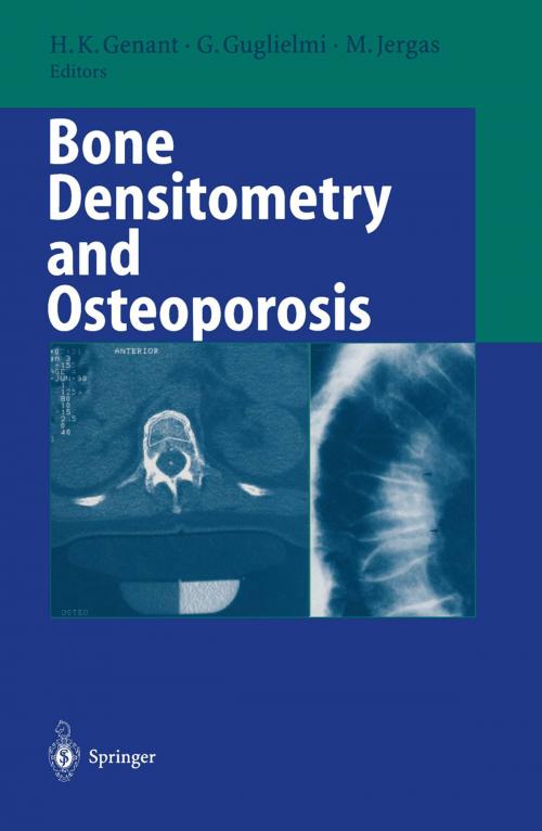 Cover of the book Bone Densitometry and Osteoporosis by , Springer Berlin Heidelberg