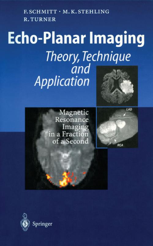 Cover of the book Echo-Planar Imaging by Franz Schmitt, Michael K. Stehling, Robert Turner, Springer Berlin Heidelberg