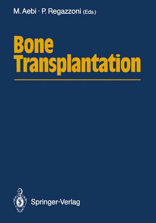 Cover of the book Bone Transplantation by , Springer Berlin Heidelberg