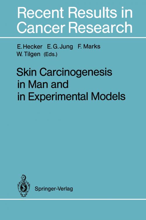Cover of the book Skin Carcinogenesis in Man and in Experimental Models by , Springer Berlin Heidelberg