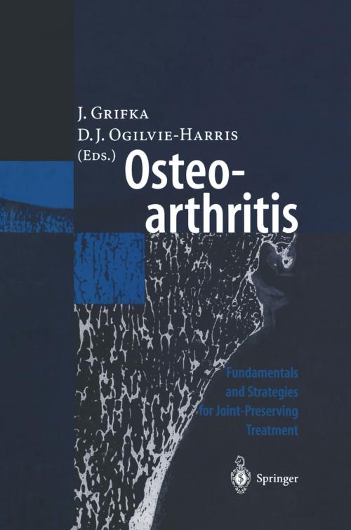 Cover of the book Osteoarthritis by , Springer Berlin Heidelberg
