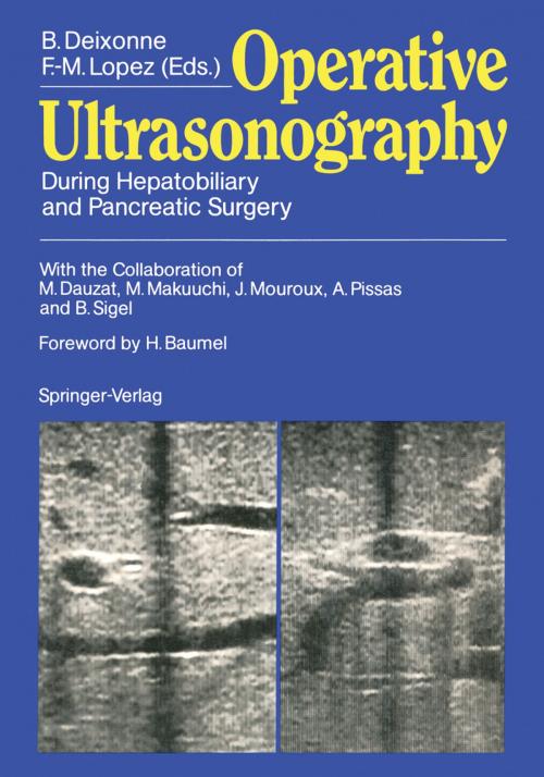 Cover of the book Operative Ultrasonography by M. Dauzat, M. Makuuchi, J. Mouroux, A. Pissas, B. Sigel, Springer Berlin Heidelberg
