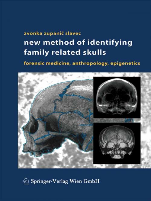 Cover of the book New Method of Identifying Family Related Skulls by Zvonka Zupanic Slavec, Springer Vienna