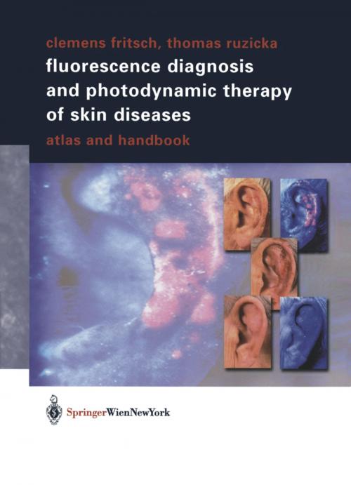 Cover of the book Fluorescence Diagnosis and Photodynamic Therapy of Skin Diseases by Clemens Fritsch, Thomas Ruzicka, Springer Vienna