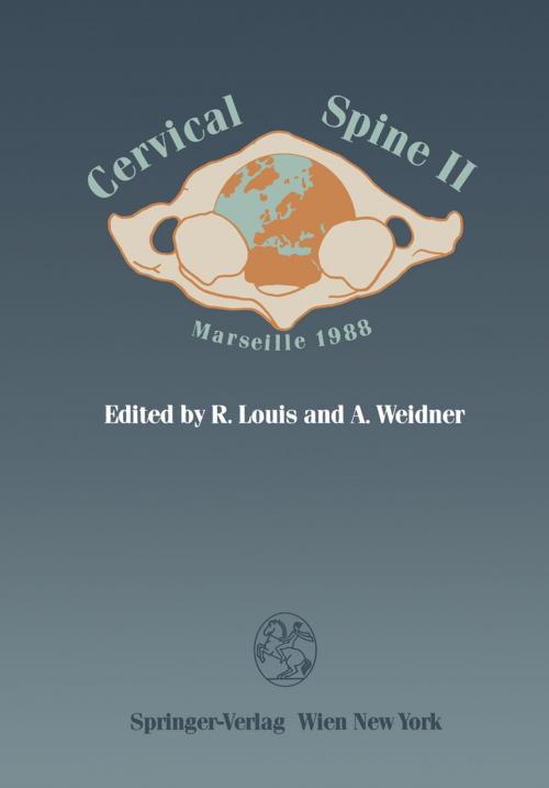 Cover of the book Cervical Spine II by , Springer Vienna