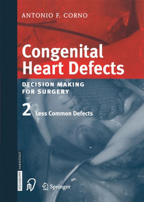 Cover of the book Congenital Heart Defects by Antonio F. Corno, Steinkopff
