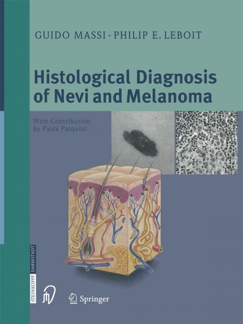 Cover of the book Histological Diagnosis of Nevi and Melanoma by P. Pasquini, Guido Massi, F. Federico, Philip E. LeBoit, F. Castri, L. Celleno, Steinkopff