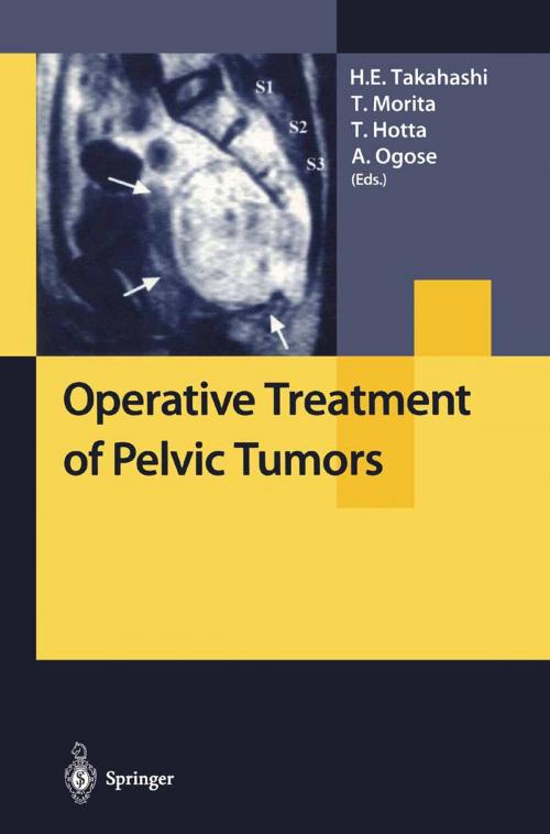 Cover of the book Operative Treatment of Pelvic Tumors by , Springer Japan