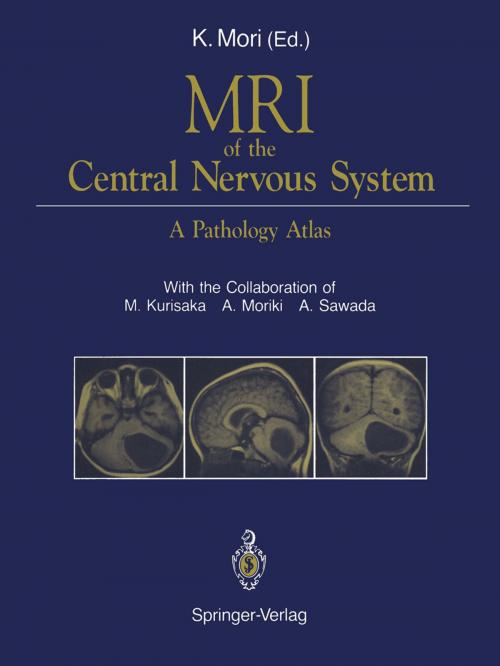 Cover of the book MRI of the Central Nervous System by M. Kurisaka, A. Moriki, A. Sawada, Springer Japan