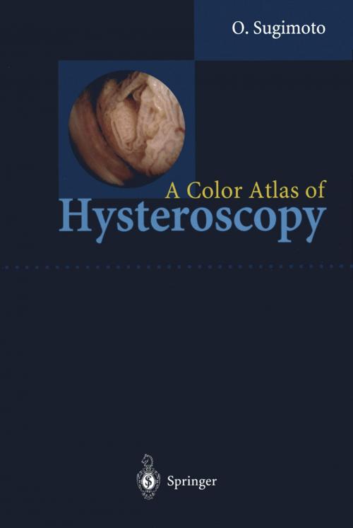 Cover of the book A Color Atlas of Hysteroscopy by Osamu Sugimoto, Springer Japan