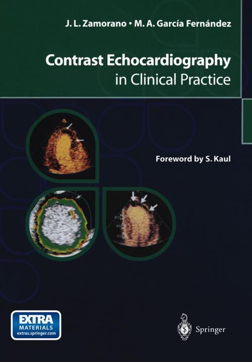 Cover of the book Contrast Echocardiography in Clinical Practice by Jose L. Zamorano, Miguel A. García Fernández, Springer Milan