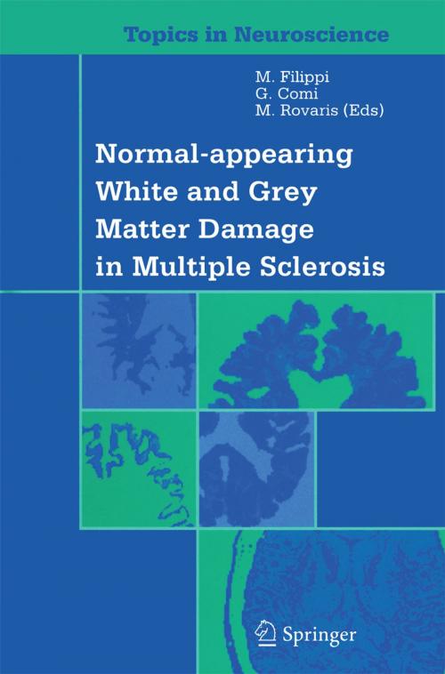 Cover of the book Normal-appearing White and Grey Matter Damage in Multiple Sclerosis by , Springer Milan