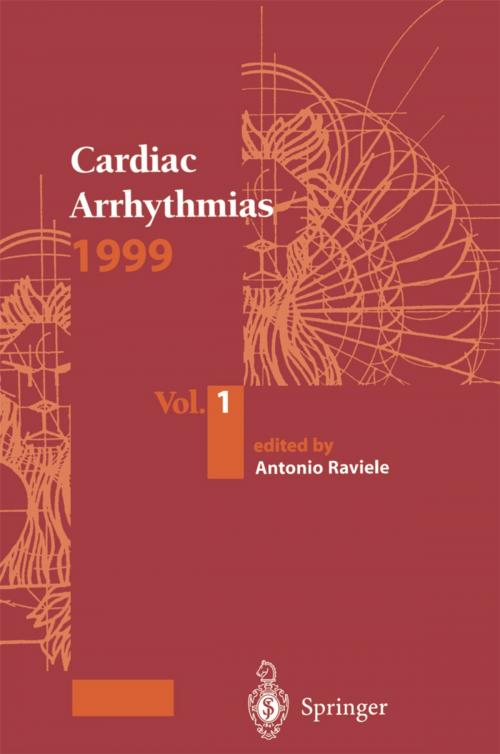 Cover of the book Cardiac Arrhythmias 1999 by , Springer Milan