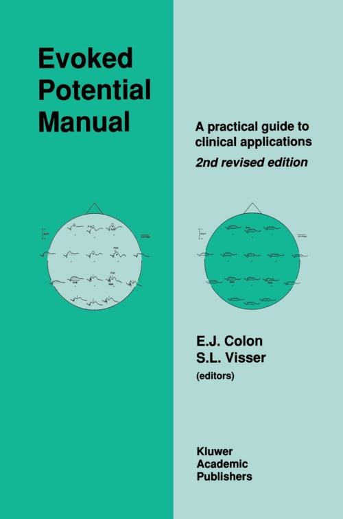 Cover of the book Evoked Potential Manual by E. Colon, S.L. Visser, Springer Netherlands
