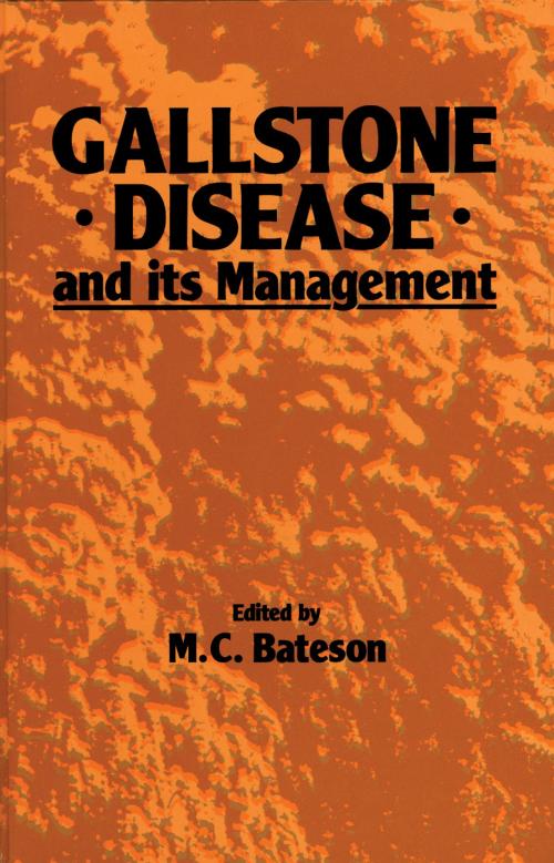 Cover of the book Gallstone Disease and its Management by , Springer Netherlands