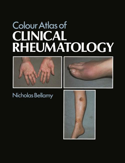 Cover of the book Colour Atlas of Clinical Rheumatology by N. Bellamy, Springer Netherlands