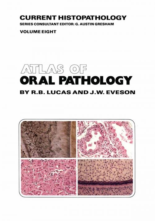 Cover of the book Atlas of Oral Pathology by R.B. Lucas, J.W. Eveson, Springer Netherlands